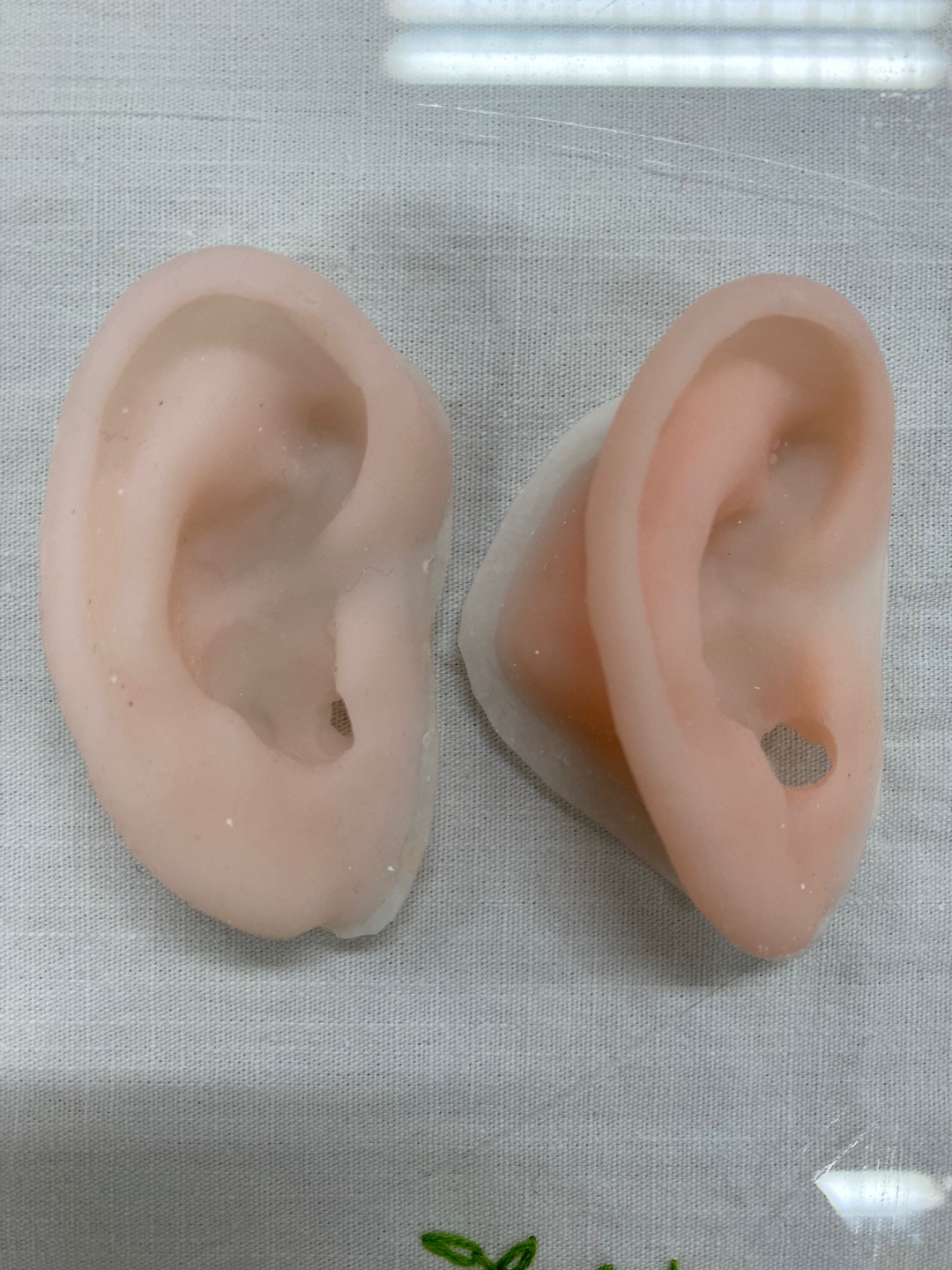 디지털 고정성 보철 · Ear Duplication